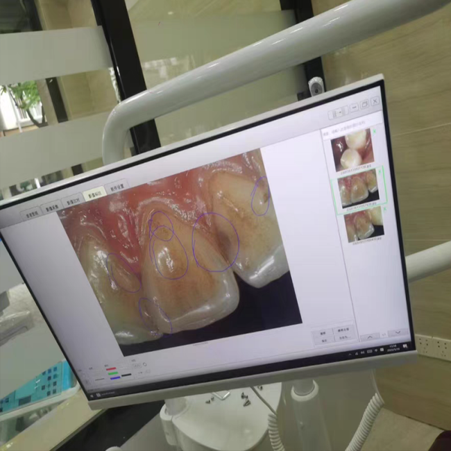 Dentalisches WLAN All-in-One-Intraorale Camera mit 24-Zoll-Touchscreen